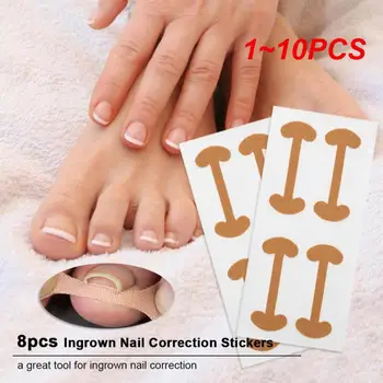 1~10PCS Prst Deformity Jedinečné Účinné, Pohodlné Pohodlné Rýchle Inovatívne Nechtov Straightener Toe Nail Deformácie Fixer